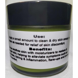 NuSkyn Herbal Eczema & Psoriasis Salve
