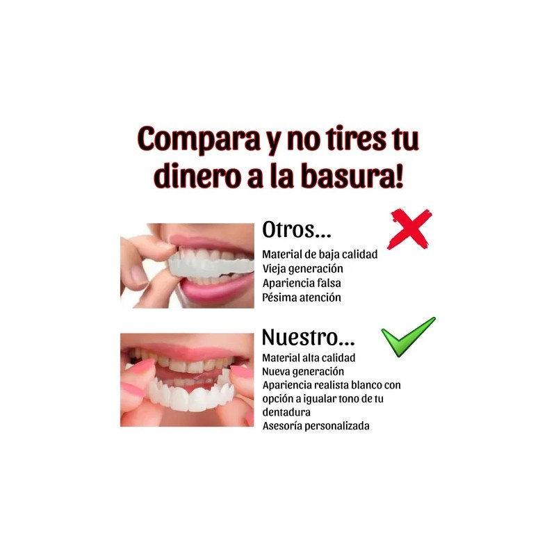 Carillas Estéticas Snap On Smile Veneers Dientes Temporales