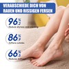60% Urea Cream Foot Cream for Cracked Heels and Dry