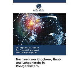Nachweis von Knochen-, Haut- und Lungenkrebs in Röntgenbildern