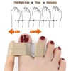 szemauy Toe Spacers for Women & Men - Bunion Corrector