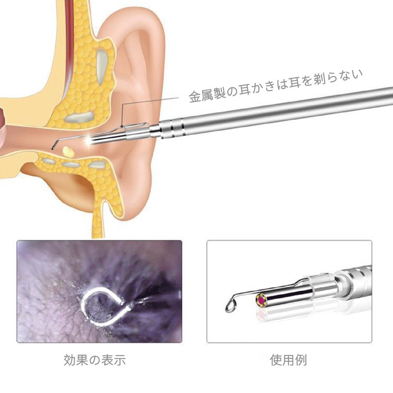耳かき カメラ 耳掃除カメラの部品 10点セットには9つの 耳掃除 スコープ 付属品 耳掃除に適した3.9mmの耳掃除ツール、専用ボックスが付属しています。