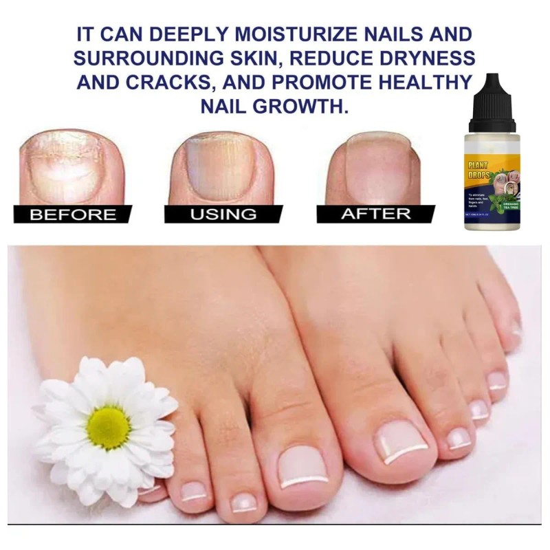 Gotas De Plantas Para El Cuidado De Las Uñas, Aceite