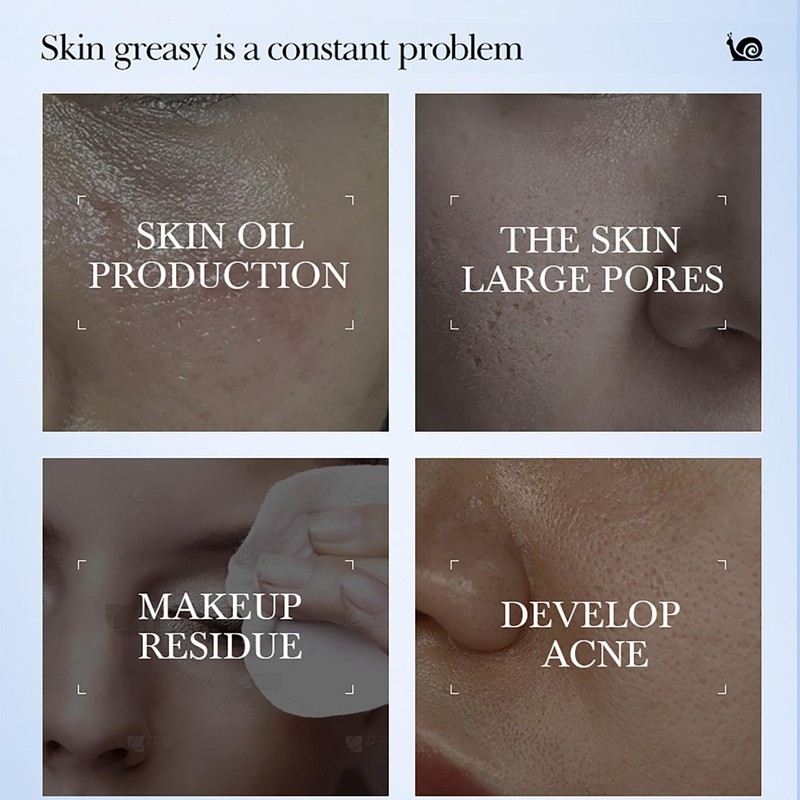 ARCHIDATE Snail Essnece Skin Care Set Gift Set