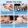 ClearPatch Acne Treatment Hydrocolloid Pimple Patches, Magic Pimple Patch, Acne