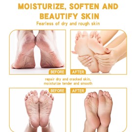 Honey Foot Cream,Hand & Foot Cream for Very Dry Feet & Hands,Cracked Heel Repair Cream,Foot Mask,Foot Moisturiser,Hard Skin Remover,He/el Balm for Cracked H/eel,Feet Cream,F/oot Balm