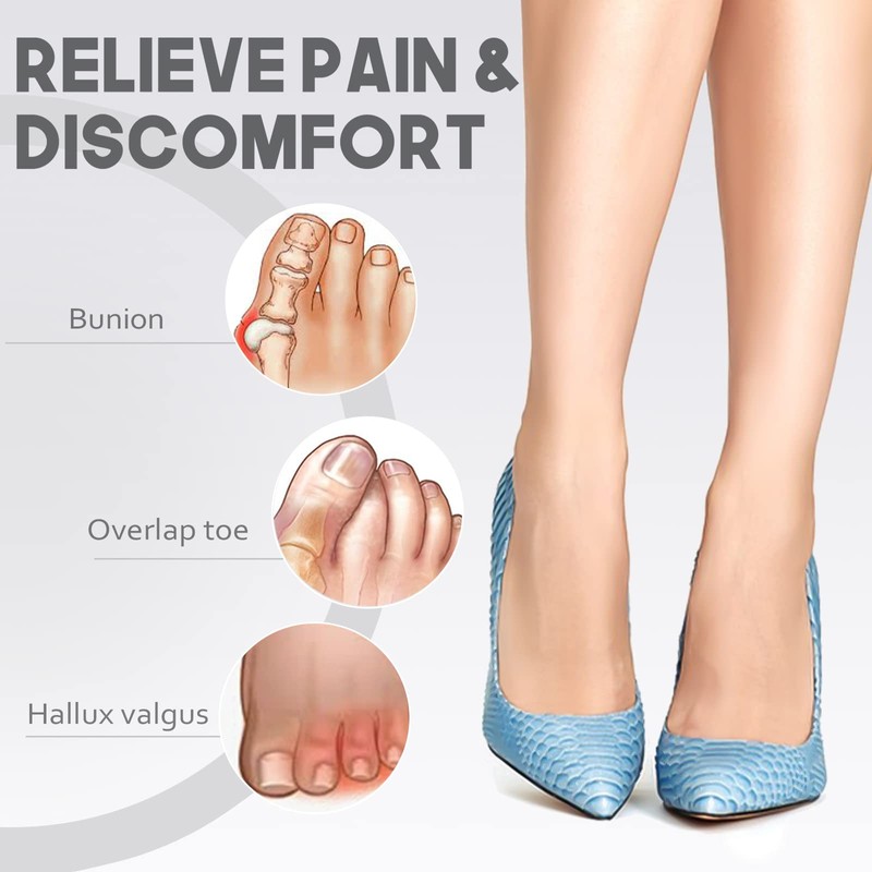 MHSY Gel Toe Separators for Overlapping Toes, 4PCS Bunion Correctors