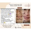 Crema Aclaradora Quita Manchas Paño Y Sol Melasma Todo Tipo