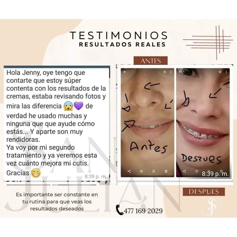 Crema Aclaradora Quita Manchas Paño Y Sol Melasma Todo Tipo