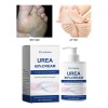 Crema De Urea 60%, Crema Para Pies 100 G, Crema