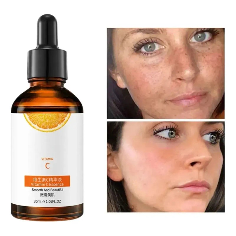 Serum Vitamina C Anti Envejecimiento Elimina Manchas 30ml