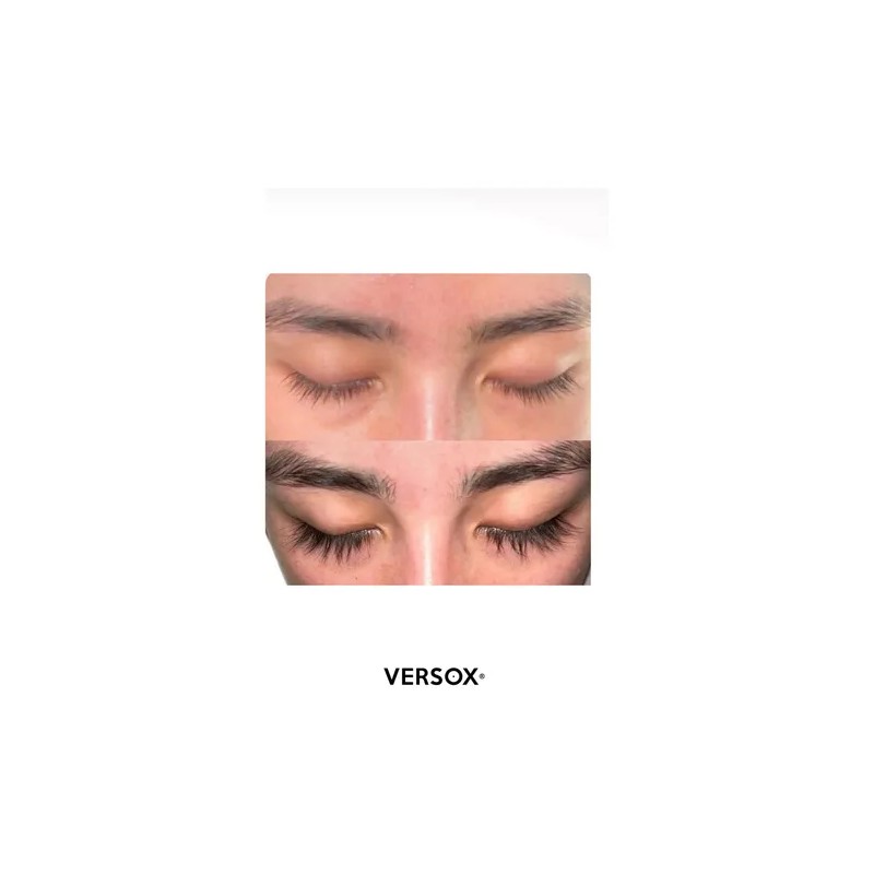 Versox Crecimiento Pestañas - Tratamiento Efectivo