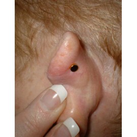 Magnetic Less Stress Acupressure Magnets Two Personal Kits New Plastic Bag 2025 Success