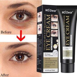Under Eye Cream Remove Dark Circles Bags Face Lines Ageless Wrinkles Puffy Eye