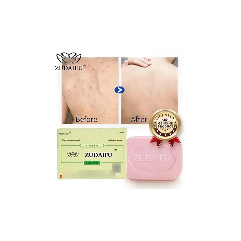 Jabon Zudaifu Original Para Psoriasis Y Bacterias En La Piel