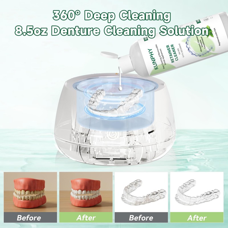 Ultrasonic Retainer Cleaner Solution Concentrate-Professional Cleaning of Retainers, Denture, Invisible
