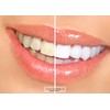 CleanCarbon24 Activated Carbon Teeth Whitening Powder Mint, 100% Natural, Vegan,