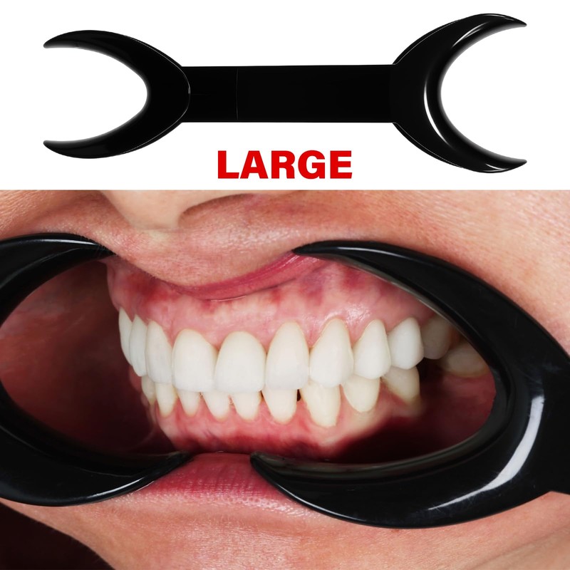NILLOS Dental Cheek Retractor, 6 PCS Double Head Mouth Opener