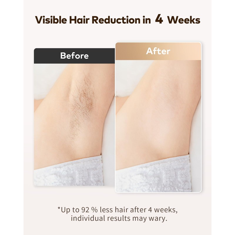 LYSMOSKI Laser Hair Removal for Women and Men, Safe at-Home