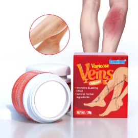 Pomada Para Aliviar La Hinchazón Vascular Y El Dolor De Las