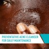 Cerave Limpiador Jabón Espuma Limpiadora Acné Control Imperfecciones Espinillas Pieles