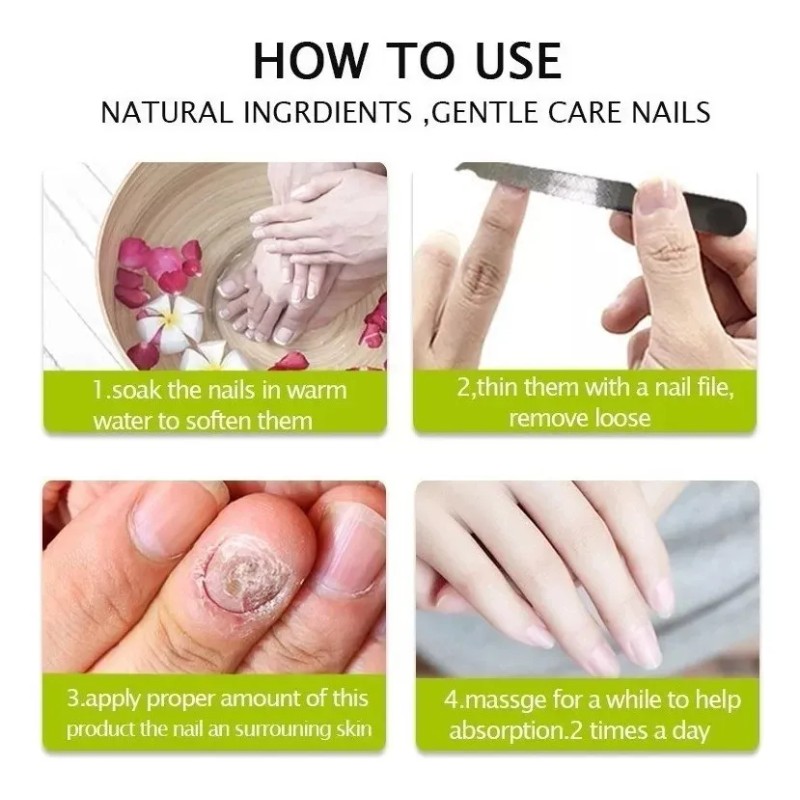 Gel Antihongo Tratamiento Reparador De Uñas Efero 2 Piezas