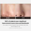Medicube Zero Pore Pad 2.0 70 Pads
