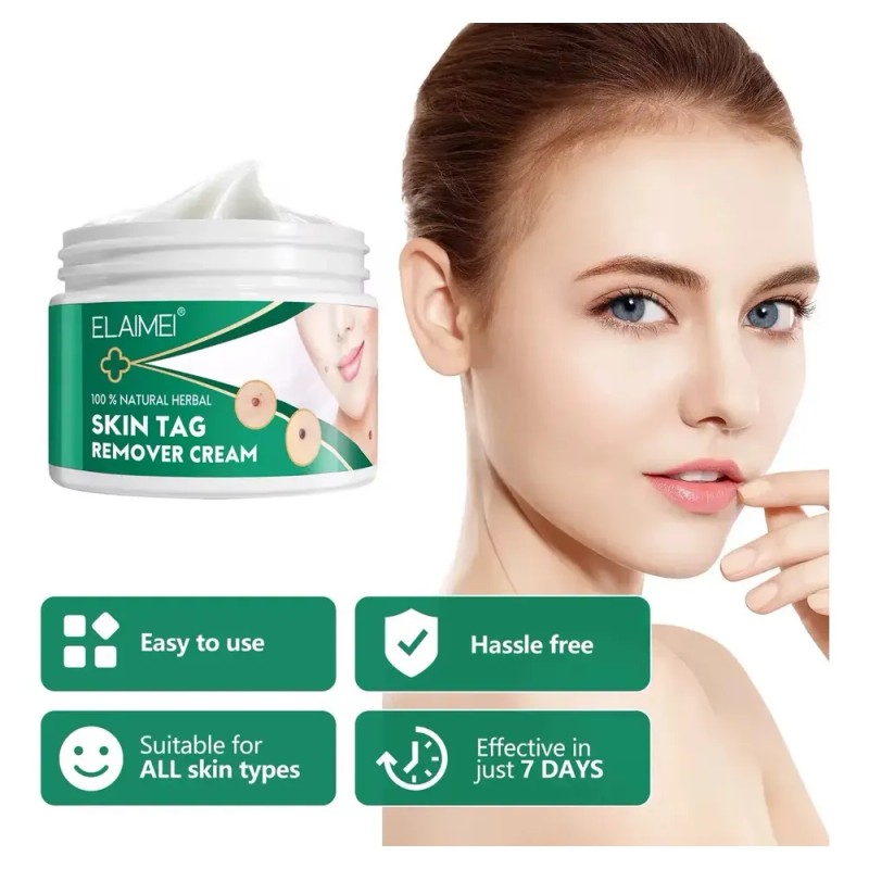 Crema Removedora Eficaz Mezquinos Verrugas Lunares Sin Dolor