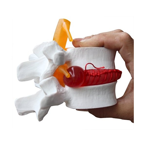 BoNew-Oral 1:1.5 Vértebras anatómicas lumbares humanas degenerativas Lumbar, modelo de columna vertebral humana, color blanco