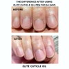 Elite Cuticle Oil Pen – Nail Growth Oil with Jojoba,