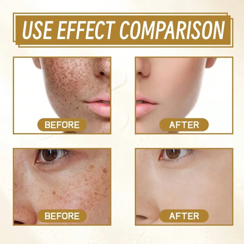 Crema Quitamanchas Hidratante 20g Para Rostro Todo Tipo De Piel