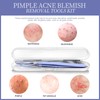 Teenitor Blackhead Remover Tools, Pimple Popper Tool Kit, Ingrown Hair