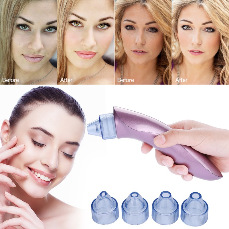 4 Replaceable Heads Blackhead Vacuum Removal Pore Acne Suction Cleanser