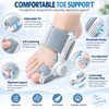 Adjustable Toe Alignment Corrector for Daily Foot Support – Soft