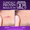 Cicatricure Advanced Scar Gel for Face & Body - Proven