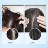Bablabear- Exfoliante para el cuero cabelludo, tratamiento para la picazón