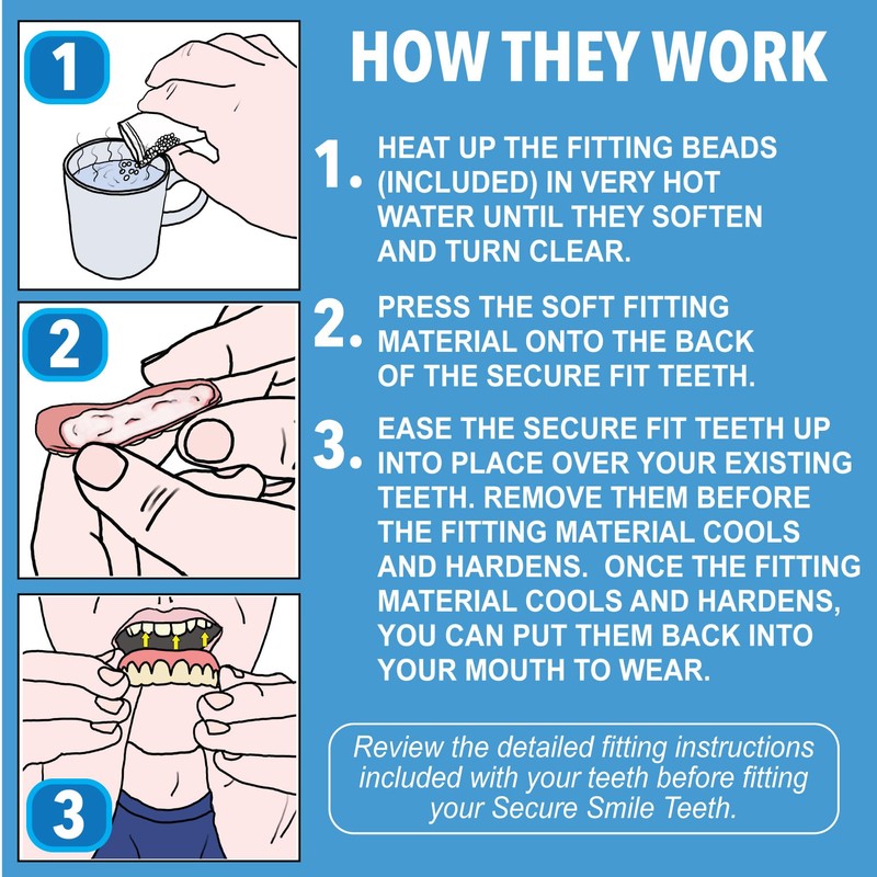 Instant Smile Secure Fit Upper Teeth Veneer -