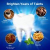 28 Tiras Blanqueadoras Dentales 5d White Higiene Bucal