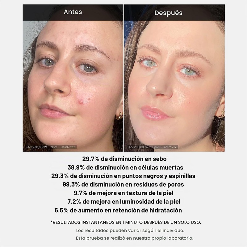 Medicube Exfoliante de Enjuague con cido al 21%