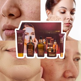 Set 5 Piezas Cuidado Facial Caviar Yeast Moisturizing Kit Rutina Facial Coreana Completa Piel Reseca Extracto Caviar Acido Hialuronico Anti Arrugas Lineas de Expresion