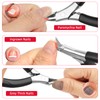 AOOWU Toenail Clippers for Ingrown Toenail, Straight Blade Podiatrist Nail