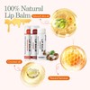 Dmsky Fruit Lip Balm Bulk - Hydrating for Men, Women,