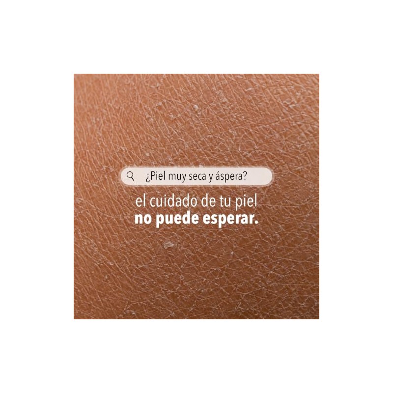 Derman Calm Emulsión Corporal Urea Ácido Hialurónico 400