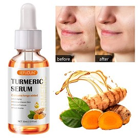 NIFEISHI- 【Ingredientes puramente naturales】El suero corrector de manchas oscuras de cúrcuma está formulado con ingredientes totalmente naturales conocidos por nutrir la piel, como la cúrcuma y el ace