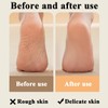 Rasp Pedicure Tools Pumice Stone for Feets, Dead Skin Remover