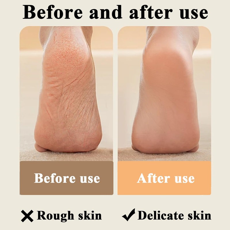Rasp Pedicure Tools Pumice Stone for Feets, Dead Skin Remover