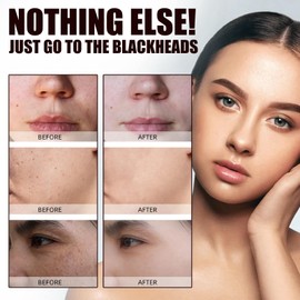 Niacinamide Serum,Dark Spot Remover for Face,Anti Wrinkle Face Cream,Hydrating Serum,Face Serum for Women,Facial Moisturiser,Serums Skincare,Dark Spot Corrector,Skin Tightening Cream for Face