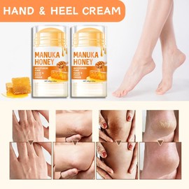 2PCS Honey Foot Cream - Cracked Heel Repair - Intensive Moisturizing Hand & Foot Cream for Very Dry Skin - For Women & Men
