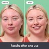 Hero Cosmetics Rescue Balm Post-Blemish Recovery Cream & Red Colour
