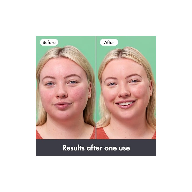 Hero Cosmetics Rescue Balm Post-Blemish Recovery Cream & Red Colour